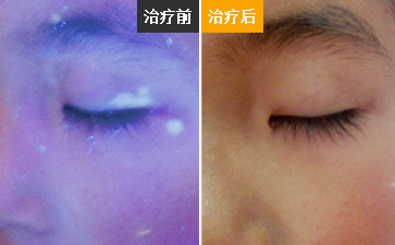 舟山最好的白癜风专科医院